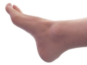 What Causes Black Toenails and What to Do About Them