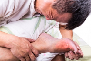 What Causes a Buildup of Uric Acid and Gout?