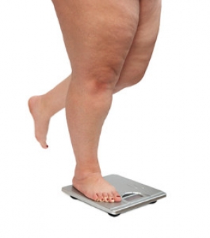 Study Finds Link Between Weight and Level of Foot Pain