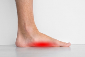 Flat Feet and the Military