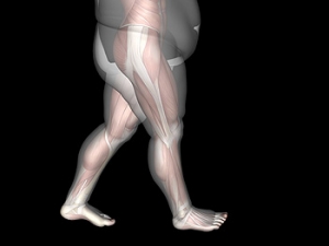 Obesity, Diabetes, and Foot Conditions