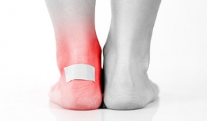 Preventing Blisters Is the Best Way to Cure Them