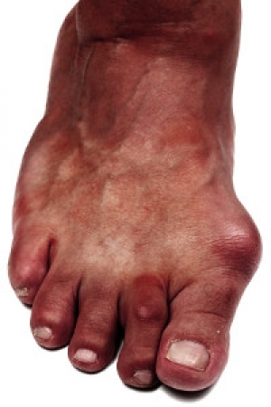 Helpful Tips for Proper Foot Care